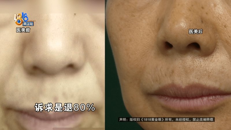 119万医美消费全景复盘:定价体系、风险边界与维权路径技术指南 新闻 119万医美消费全景复盘:定价体系、风险边界与维权路径技术指南 新闻 119万医美消费全景复盘:定价体系、风险边界与维权路径技术指南 新闻 119万医美消费全景复盘:定价体系、风险边界与维权路径技术指南 新闻 119万医美消费全景复盘:定价体系、风险边界与维权路径技术指南 新闻 119万医美消费全景复盘:定价体系、风险边界与维权路径技术指南 新闻 119万医美消费全景复盘:定价体系、风险边界与维权路径技术指南 新闻 119万医美消费全景复盘:定价体系、风险边界与维权路径技术指南 新闻