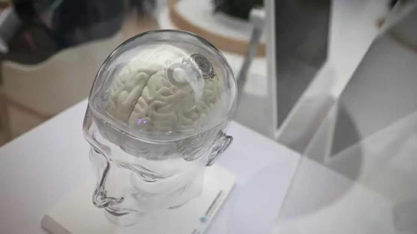 技术突破与资本热潮:脑机接口产业商业化路径深度解析 汽车科技